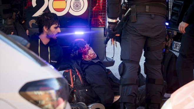 Un alumno herido por las cargas policiales durante una manifestación en el campus de Ciudad Universitaria. A. Pérez Meca / Europa Press Un alumno herido por las cargas policiales durante una manifestación en el campus de Ciudad Universitaria. A. Pérez Meca / Europa Press