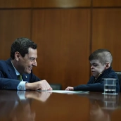 La sanidad en la Andalucía de Juanma Moreno vuelve a destacar: primera en España en aplicar una terapia pionera para la ‘piel de mariposa’