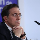El ministro de Exteriores, José Manuel Albares. Alejandro Martínez Vélez / Europa Press