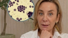 ¿Piel más apagada, caída del cabello o dolor en las articulaciones? La Doctora Enriqueta Garijo explica por qué el PRP está ganando popularidad