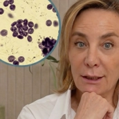 ¿Piel más apagada, caída del cabello o dolor en las articulaciones? La Doctora Enriqueta Garijo explica por qué el PRP está ganando popularidad